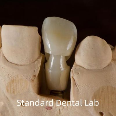 Implant dentaire Tibase Zirconia Abutment Titane précision personnalisée