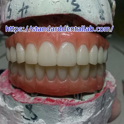 Implant dentaire couronne temporaire pont PMMA avec porcelaine rose