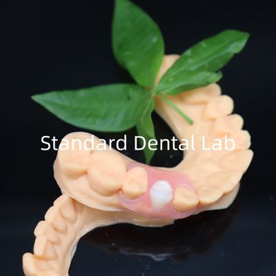 Des prothèses esthétiques à dentition flexible avec une politique de remodelage gratuite en 3 jours