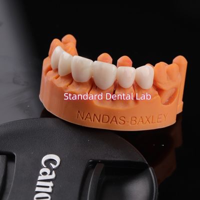 Confort et fonctionnalité avec le laboratoire dentaire numérique CAD CAM