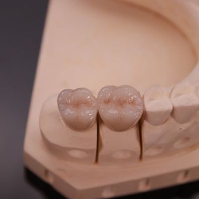 Couronne de zirconium confortable avec une finition esthétique précise Express 3-4 jours Temps de traitement