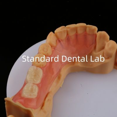 Les dents d'as sont de couleur rose/obscur TCS Valplast Prothèses partielles flexibles pour une esthétique élevée Modèle d'impression 3D dentaire