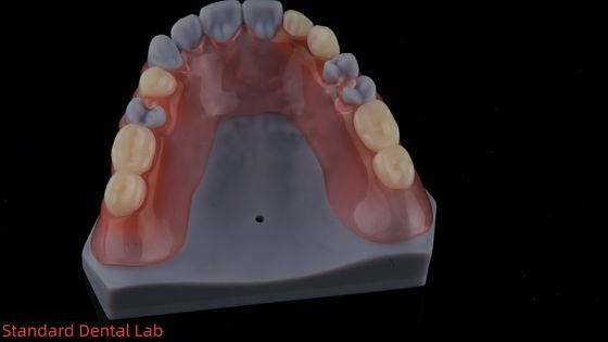 Modèle d'impression 3D Dentistique haute esthétique TCS Valplast Flexible Prothèses partielles Laboratoire dentaire