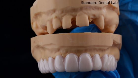 Appareil dentaire amovible de laboratoire dentaire standard