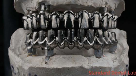 Dental Hybrid Malo Implant Bridge professionnel en parfait ajustement certifié FDA