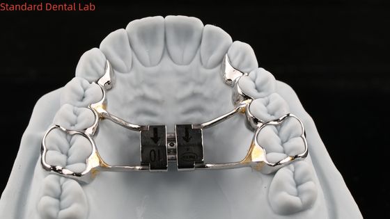 Expansionneur de palais de dents d'arc Stable Hyrax Expansionneur de palais de dentition SDL Appareil d'orthodontie de laboratoire dentaire