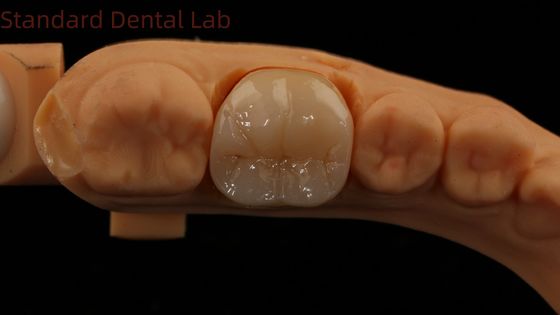 Une couronne dentaire numérique en zirconium complet avec Noritake Porcelaine 3D Print Modèle 5 ans de garantie