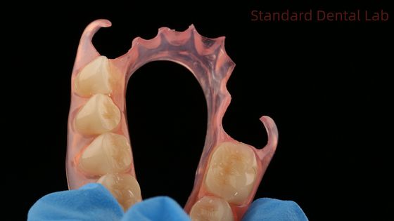 Dentiste TCS Valplast Flexibles Prothèses partielles Laboratoire dentaire Modèle d'impression 3D Esthétique élevée