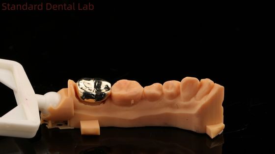 Le dentiste professionnel de la couronne d'or jaune est agréé ISO et FDA.