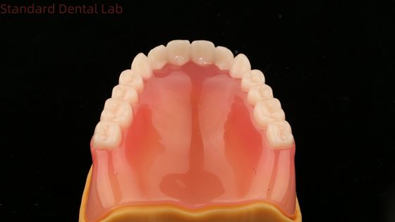 La dentition complète Ivoclar dentition complète Acrylique Les dents SDL Laboratoire dentaire
