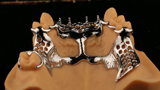 Cadre de coulée supérieure Prothèses partielles en acrylique métallique Forte légère et durable