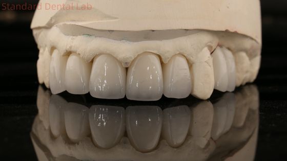 Chine Laboratoire dentaire Zirconia couronne de contour complet haute esthétique pont dentaire naturel 5 ans de garantie