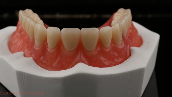 Dentsply Lucitone 199 Prothèse acrylique pour un aspect naturel à pleine voûte