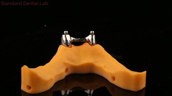 Une prothèse à barres avec pièces jointes, une prothèse à support d' implant en titane acrylique.