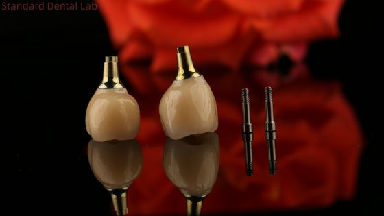 Porcelaine Zirconia Ciment Implanté à vis retenue Forme de tête hexagonale pour une esthétique personnalisée