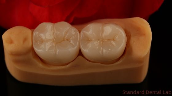Couronne en zirconium à contour complet Forteur et esthétique exceptionnelles Pas de revêtement en porcelaine Couronne postérieure Laboratoire dentaire chinois