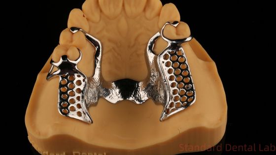Métal alliages partiels Cobalt chrome Prothèses dentaires Ivoclar Scheftner Confortable Chine Lab dentaire