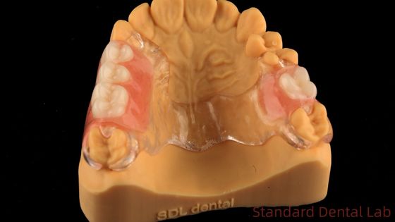 Cadre en métal fondu transparent flexible Prothèses dentaires partielles Haute esthétique Adéquation parfaite