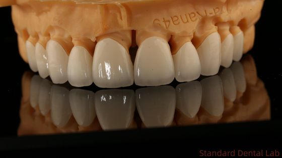 Laboratoire dentaire à contour complet couronnes à haute translucideur couronne solide en zirconium laboratoire dentaire chinois