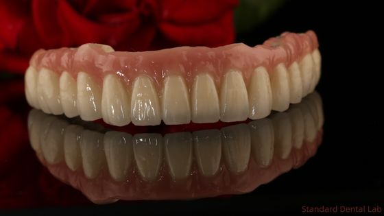Implants dentaires en titane de zirconium tous sur 4 remplacement de dents en arc complet 3 à 6 mois Temps de cicatrisation