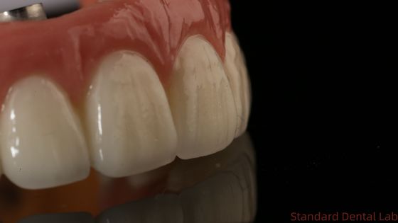 Laboratoire dentaire professionnel de la couronne d'implant dentaire en zircone en titane CAD CAM