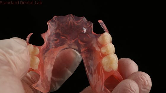 Les dents d'as sont de couleur rose/obscur TCS Valplast Prothèses partielles flexibles pour une esthétique élevée Modèle d'impression 3D dentaire