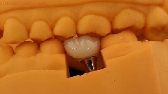 Nom