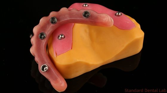 Nom