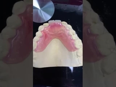 Modèle d'impression 3D Dentistique haute esthétique TCS Valplast Flexible Prothèses partielles Laboratoire dentaire