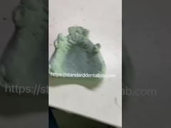 Cadre de prothèse partielle en métal Co-Cr pour les professionnels dentaires