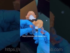 FDA Cobalt chrome cadre clair esthétique partiel