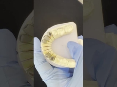 Métal coulé post-core couronne Cocr Rétentive précis complet Zirconia Bruxier