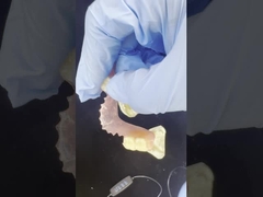 Prothèses dentaires flexibles en valplast pour un confort naturel et une qualité esthétique