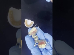 Cadre coulé en cobalt chrome personnalisable avec de très bons autocollants