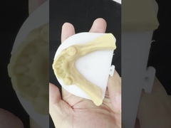 Métal alliages partiels Cobalt chrome Prothèses dentaires Ivoclar Scheftner Confortable cadre métallique