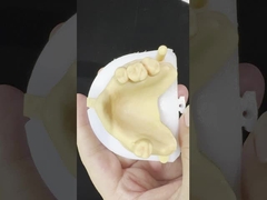 Métal alliages partiels Cobalt chrome Prothèses dentaires Ivoclar Scheftner Confortable cadre métallique