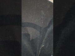 Prothèses dentaires avec implant en titane Prothèses dentaires ivoclaires précises sur les implants