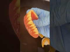 Plaque d'arrêt complète supérieure et inférieure Prothèses partielles acryliques Ivoclar Dents gomme rose